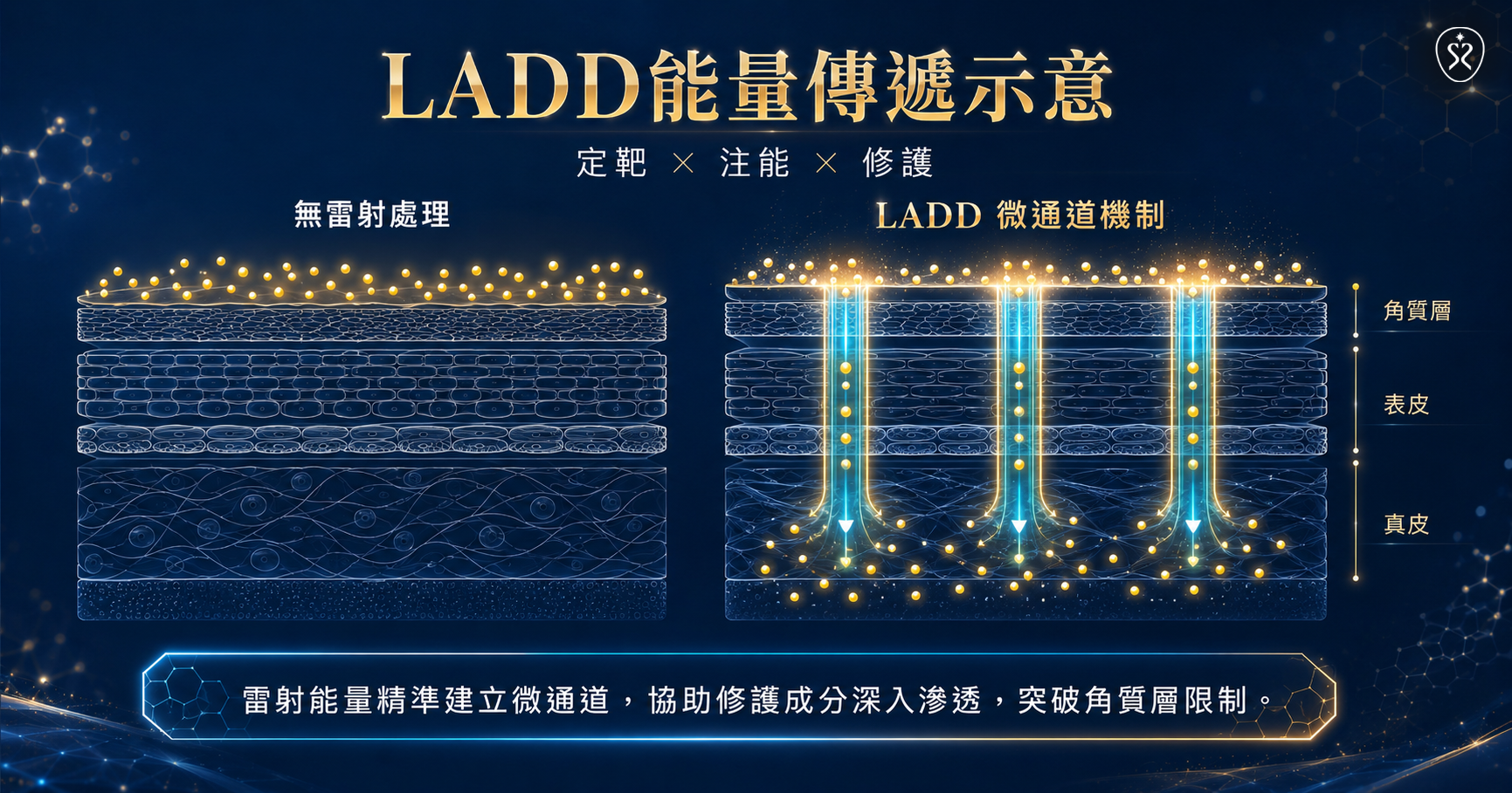 LADD傳導
